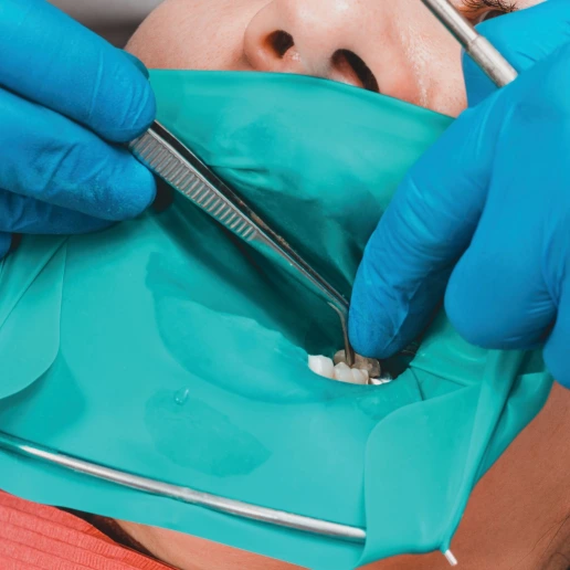 Rubber Dam ile Kök Kanal Tedavisi